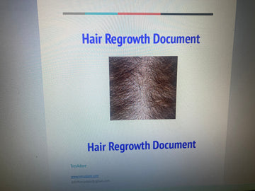 Hair ReGrowth Document